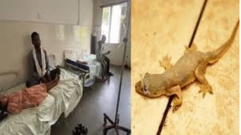 बलरामपुर में Food Poisoning का मामला: चने की सब्जी में छिपकली, परिवार के 4 सदस्य अस्पताल में भर्ती