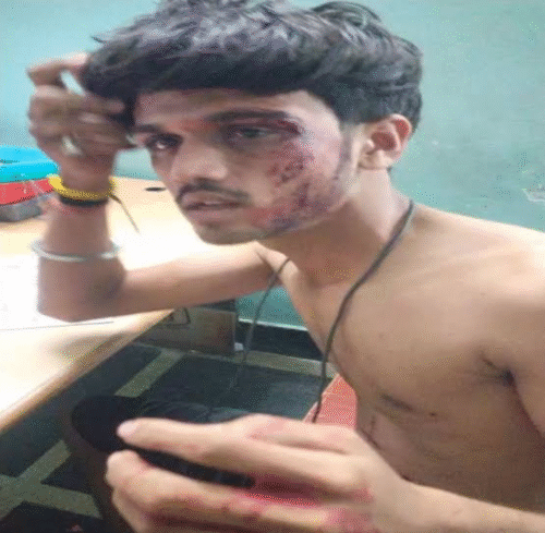 Airport रोड पर गौ-सेवक पर जानलेवा हमला, लूट और अपहरण की कोशिश