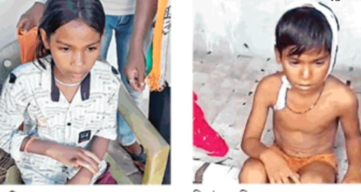 Mungeli: जर्जर School की छत का प्लास्टर गिरने से दो बच्चों को गंभीर चोटें