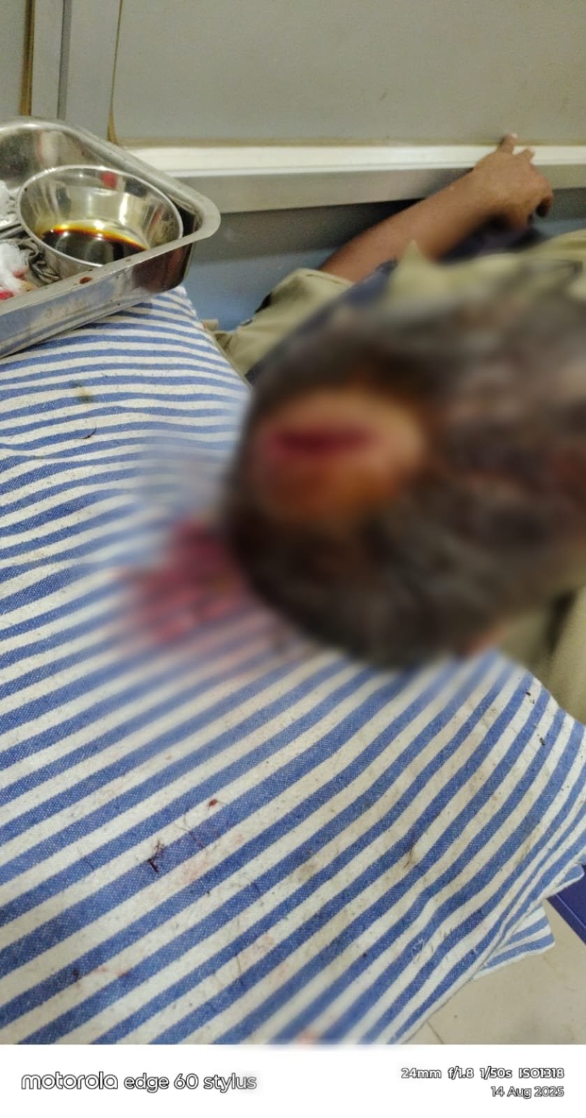 Kumhari Highway पर ट्रक चालक द्वारा पुलिसकर्मी पर हमला, सिर में गंभीर चोट—आरोपी गिरफ्तार