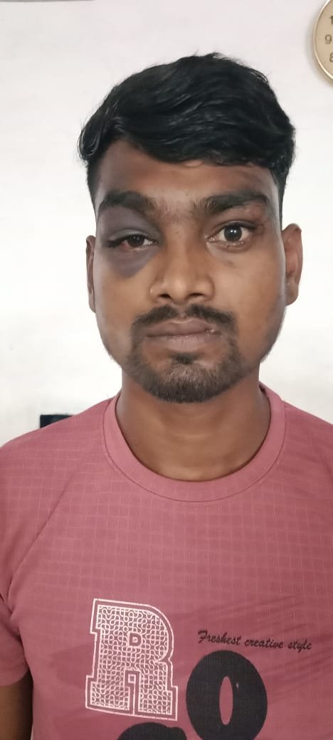 Durg:अवैध शराब के खिलाफ दुर्ग पुलिस की कड़ी कार्रवाई