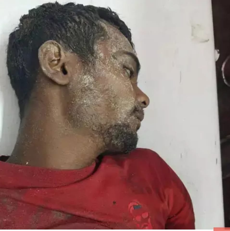 Tractor की टक्कर से Driver की दर्दनाक मृत्यु