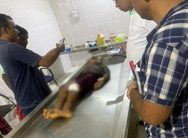 Chhattisgarh के Balrampur में आदिवासी छात्रावास में हादसा: लकड़ी काटते समय फिसला कुल्हाड़ी, छात्र का पैर घायल