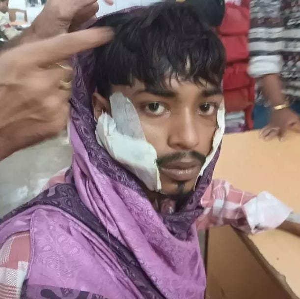 Rajnandgaon जिला जेल में गैंगवार: कैदी पर क्रूर हमला, सुरक्षा पर सवाल