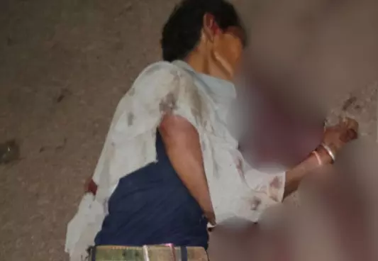 Balod: दिवाली की खुशियां मातम में बदली, खरीदारी कर घर लौट रहे युवक की सड़क हादसे में मौत