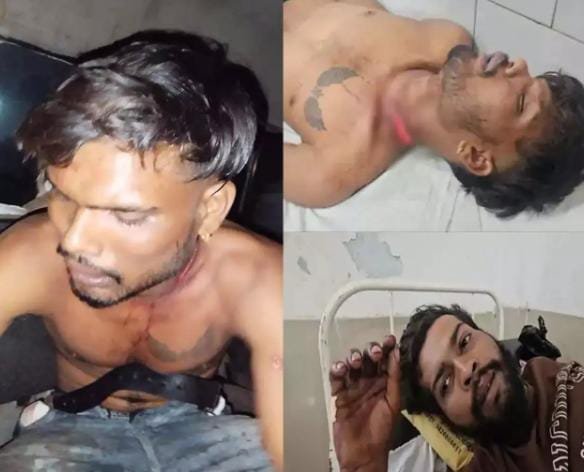 Bilaspur में दो हिंसक हमलों ने मचाई सनसनी: चाकू और सर्जिकल ब्लेड से युवकों पर हमला