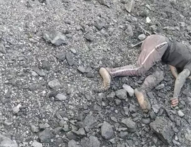 Korba में कोयला खदान में दर्दनाक हादसा: तेज रफ्तार वाहन से गिरकर चालक की मौत