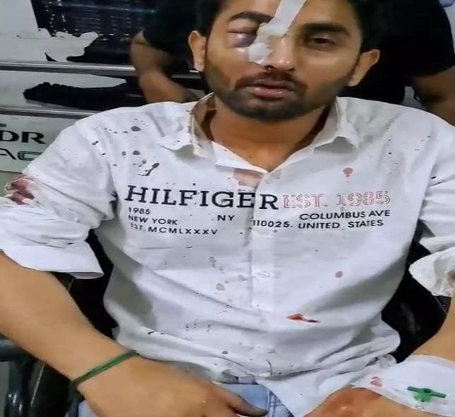 Raipur में दो पक्षों में लाठी-डंडे और घूंसे चले