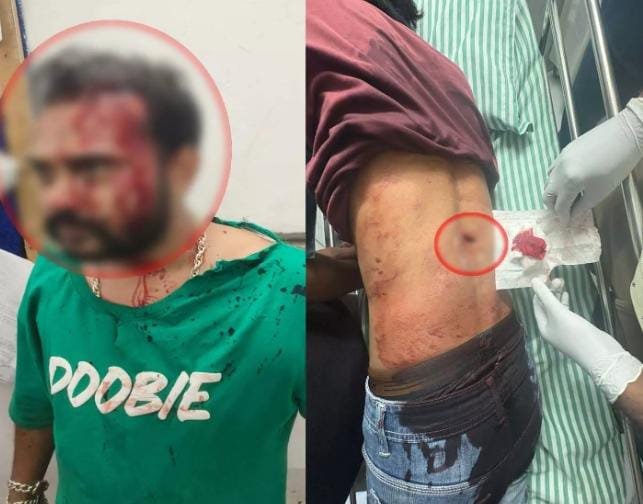 Raipur के ईदगाहभाठा में मामूली विवाद से हुई चाकूबाजी, चार युवक गंभीर रूप से घायल