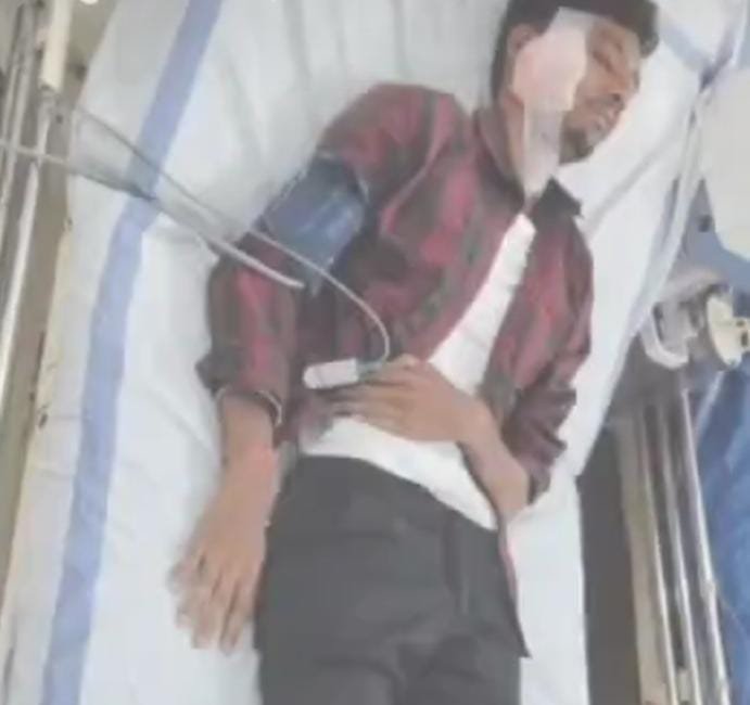 Jashpur: सड़क हादसे में दो युवक गंभीर रूप से घायल