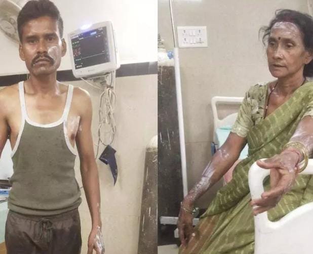 Kanker में मंदिर खोलने के विवाद ने लिया हिंसक रूप, युवक ने पड़ोसी पर फेंका उबलता तेल