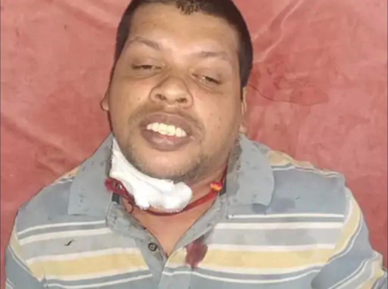 Korba : में किरायेदार बनकर आए दो युवकों ने घर में की लूट, युवक पर ब्लेड से हमला कर सोने-चांदी के जेवरात लेकर फरार