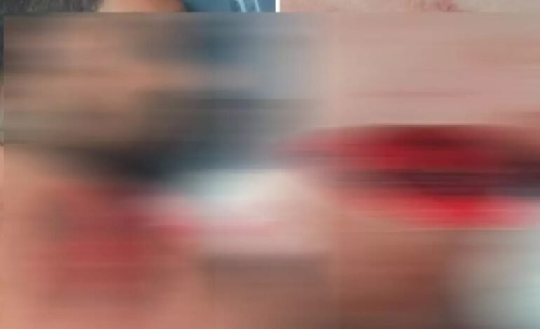 Raipur उरला में होटल मालिक पर चाकू से हमला, लूटपाट के बाद बेरहमी से पीटा: