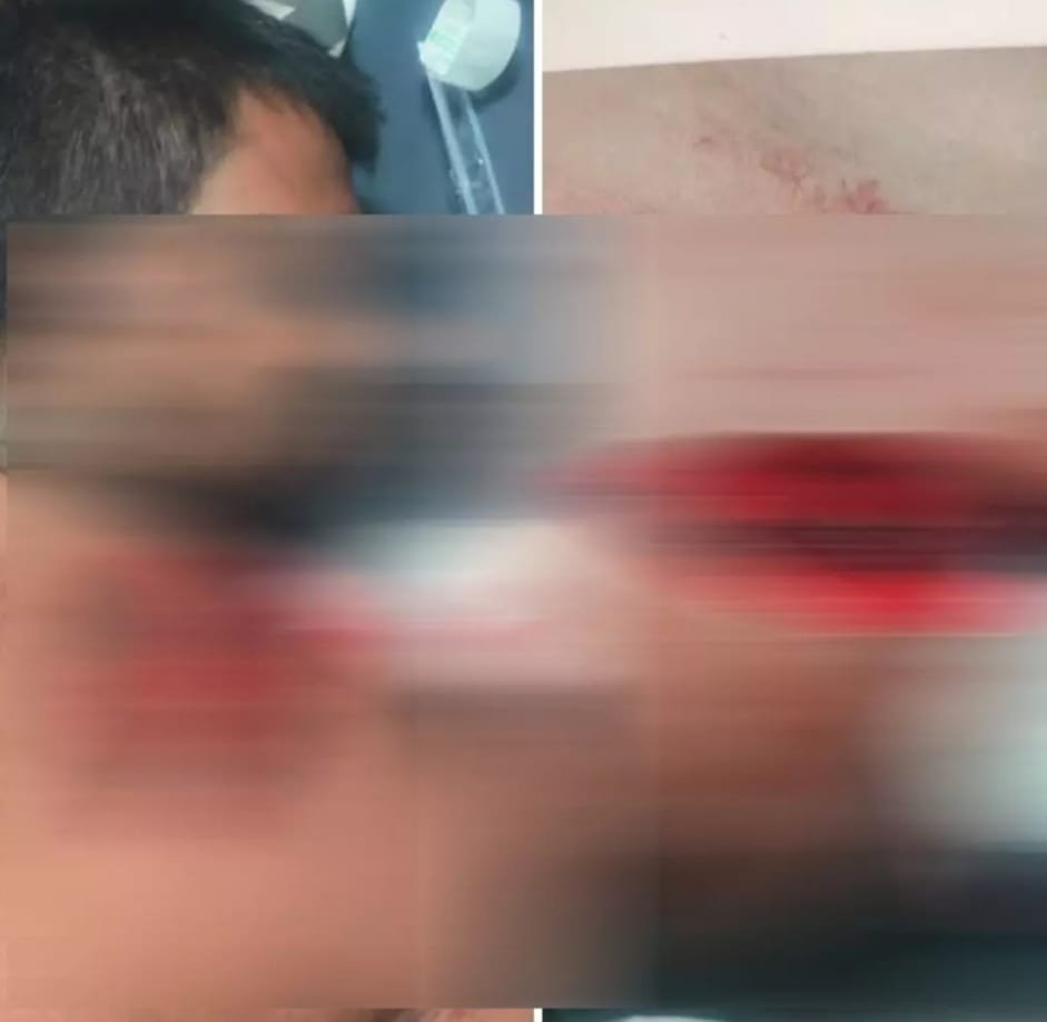 Raipur उरला में होटल मालिक पर चाकू से हमला, लूटपाट के बाद बेरहमी से पीटा: