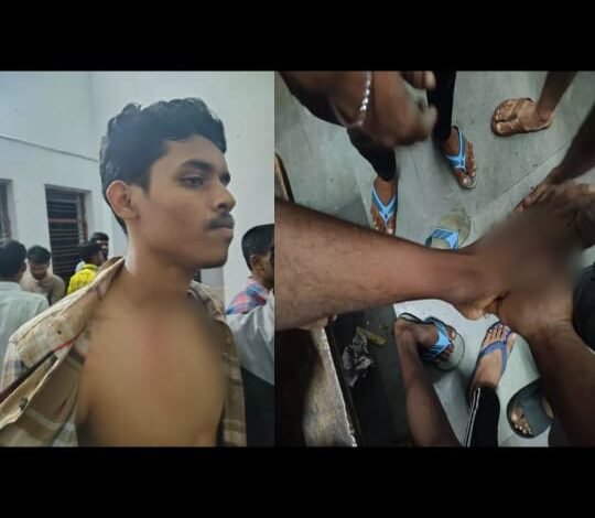 Raipur साइंस कॉलेज हॉस्टल में बाहरी गुंडों का हमला: 40-50 युवकों ने छात्रों पर लाठियां बरसाईं,