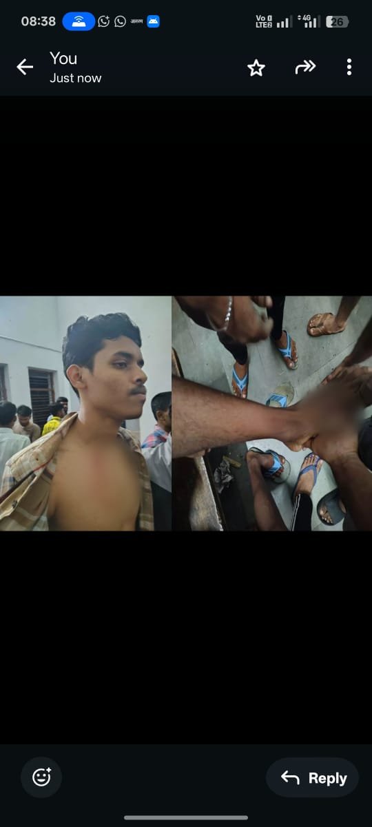 Raipur साइंस कॉलेज हॉस्टल में बाहरी गुंडों का हमला: 40-50 युवकों ने छात्रों पर लाठियां बरसाईं,