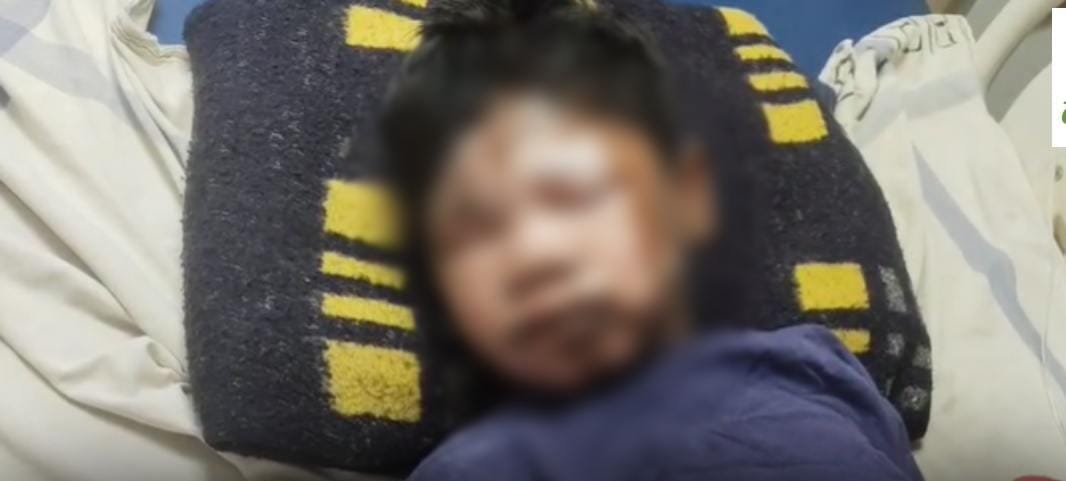 बस्तर के छात्रावास में लापरवाही: खाना बनाते समय छात्र झुलसा, अफसरों पर मामले को दबाने का आरोप