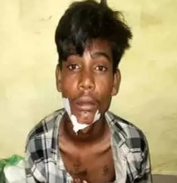 Raipur में चाकूबाजी की वारदातें थमने का नाम नहीं ले रहीं, एक की मौत, दो गंभीर घायल