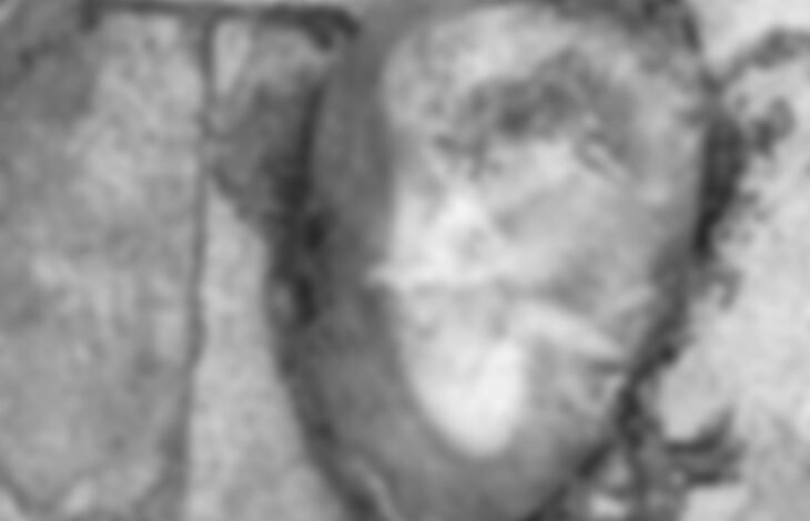 Raipur के मेकाहारा में कचरे के डिब्बे के पास मिला भ्रूण