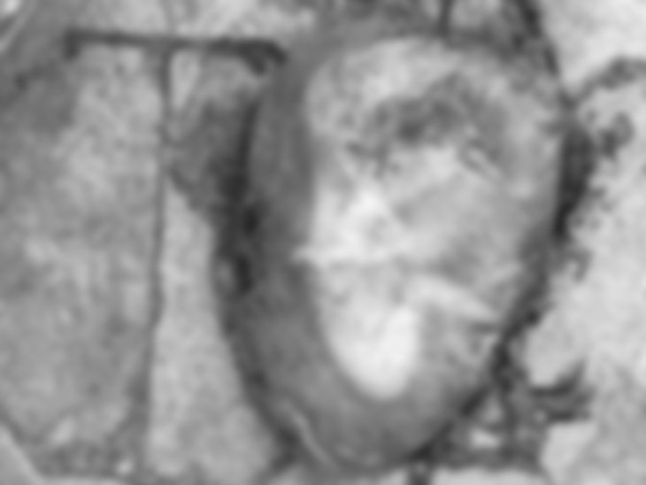 Raipur के मेकाहारा में कचरे के डिब्बे के पास मिला भ्रूण