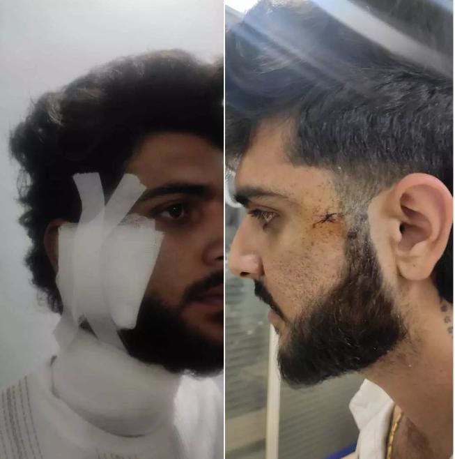 रायपुर सेंट्रल जेल में फिर खूनी खेल, यश शर्मा हत्याकांड के गवाह पर जानलेवा हमला