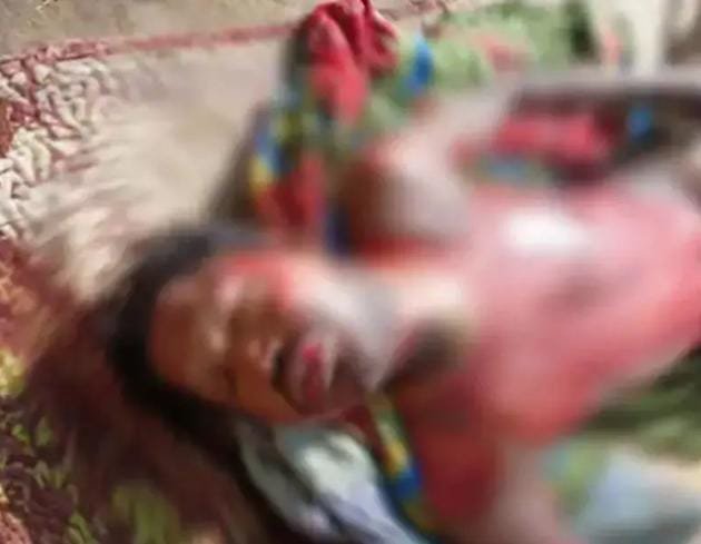 Surajpur: युवक ने खुद पर पेट्रोल डालकर लगाई आग, इलाज के दौरान मौत