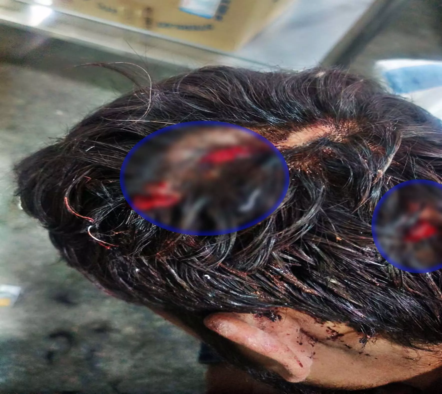 रायपुर स्टेशन पर ‘चाकूबाजी’ से मचा हड़कंप, गणतंत्र दिवस पर यात्री से 8 हजार और मोबाइल की लूट