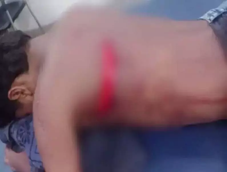 Janjgir-Champa:  क्रिकेट में हारे ‘300 रुपये’ के पीछे खूनी जंग, नाबालिग ने युवक के गले और पीठ पर मारा चाकू