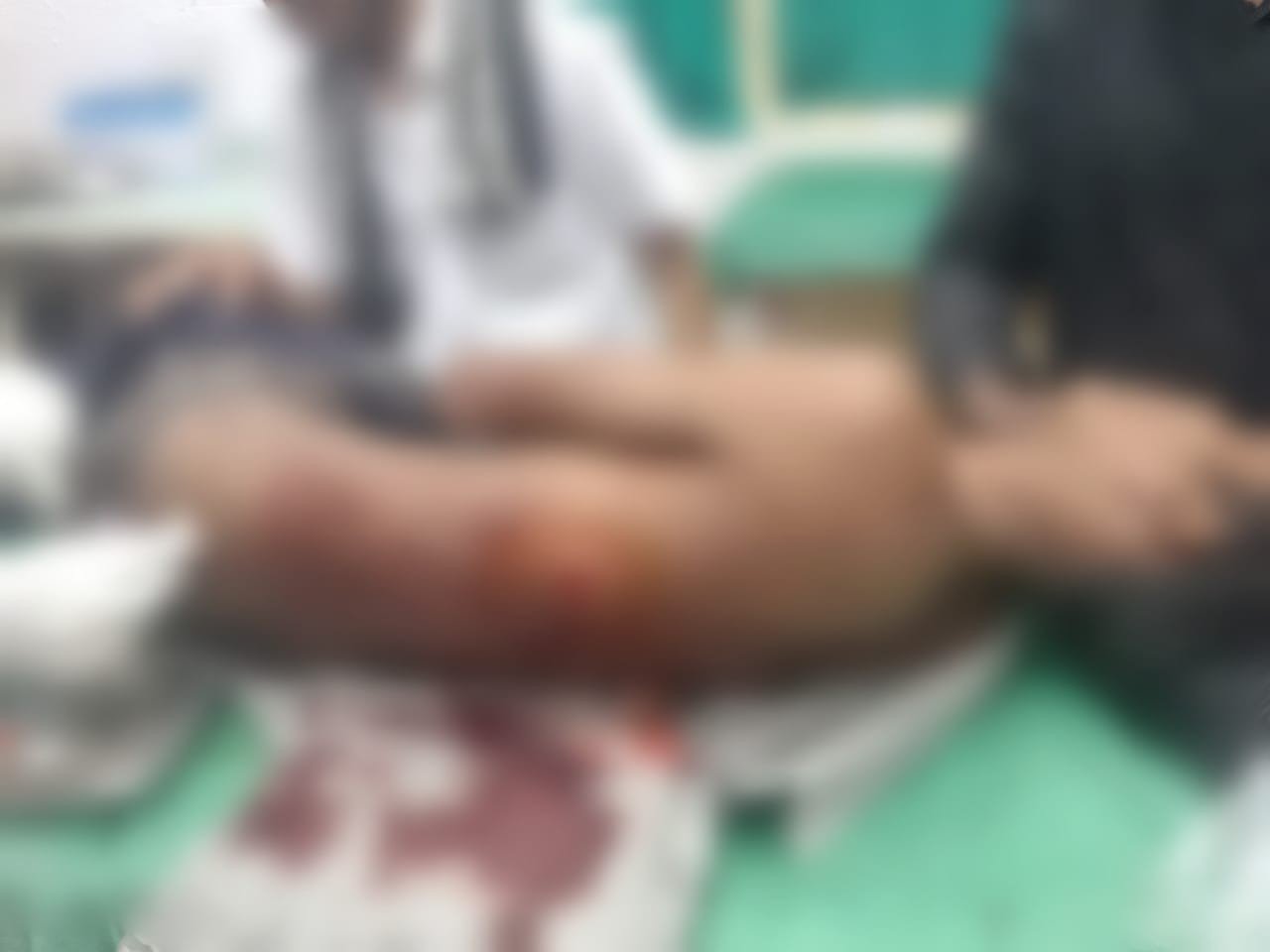 धमतरी : पैसों के लेन-देन को लेकर युवक पर चाकू से जानलेवा हमला, आरोपी फरार