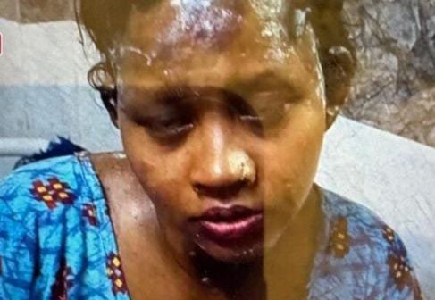 Korba: पति ने की पत्नी को जिंदा जलाने की कोशिश, चरित्र शंका में दी बड़ी वारदात को अंजाम