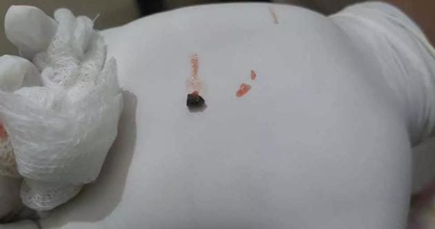 Balodabazar: स्कूल के पास एयरगन फायरिंग: छात्रा घायल, दो आरोपी गिरफ्तार