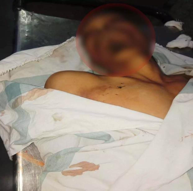 Raipur में सनसनीखेज हत्याकांड: दुर्गेश ध्रुव की चाकूबाजी से हत्या, दो आरोपी हिरासत में