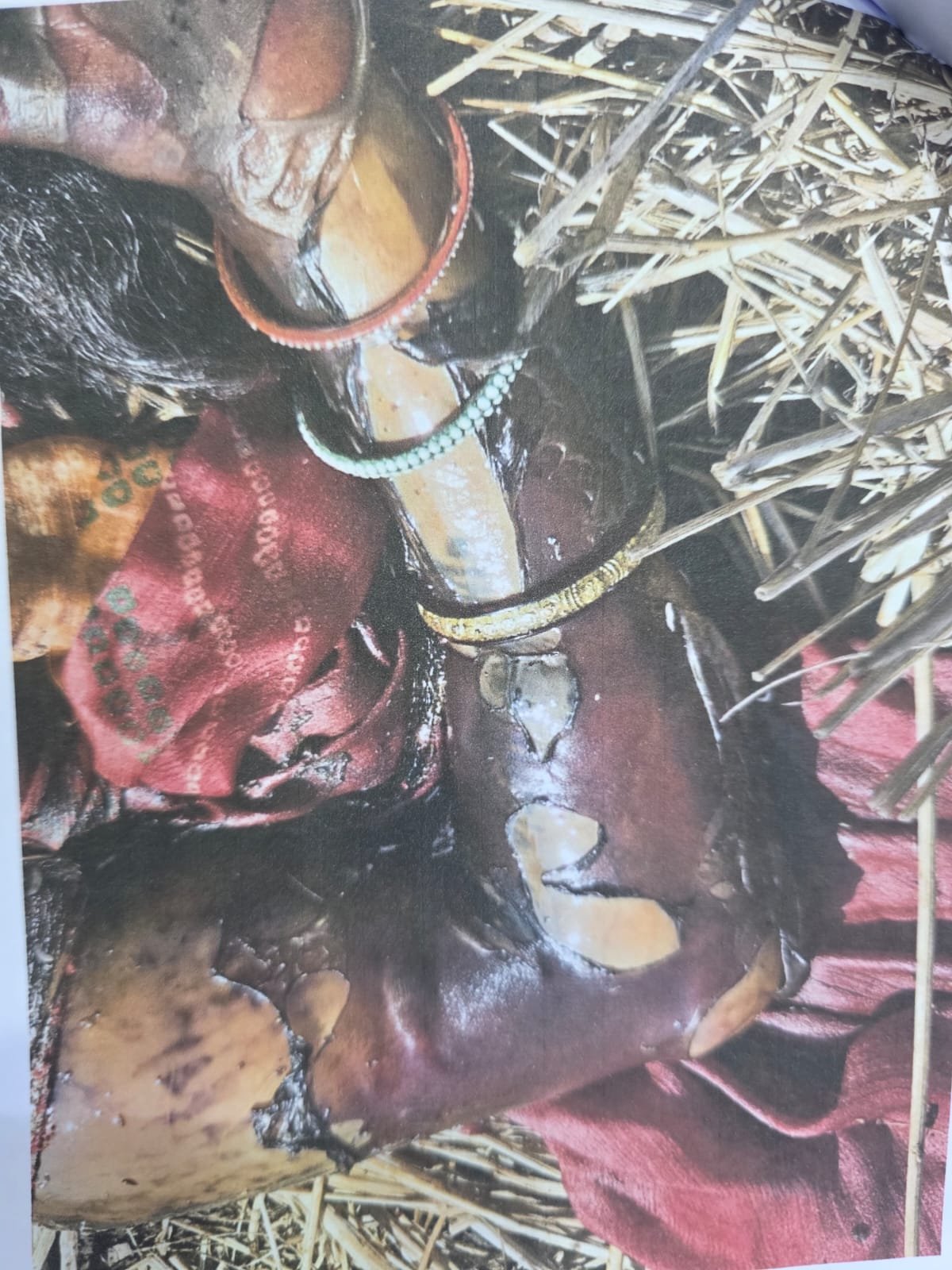 Durg:  कुम्हारी थाना क्षेत्र अंतर्गत ग्राम परसादा खार में एक अज्ञात महिला का शव बरामद